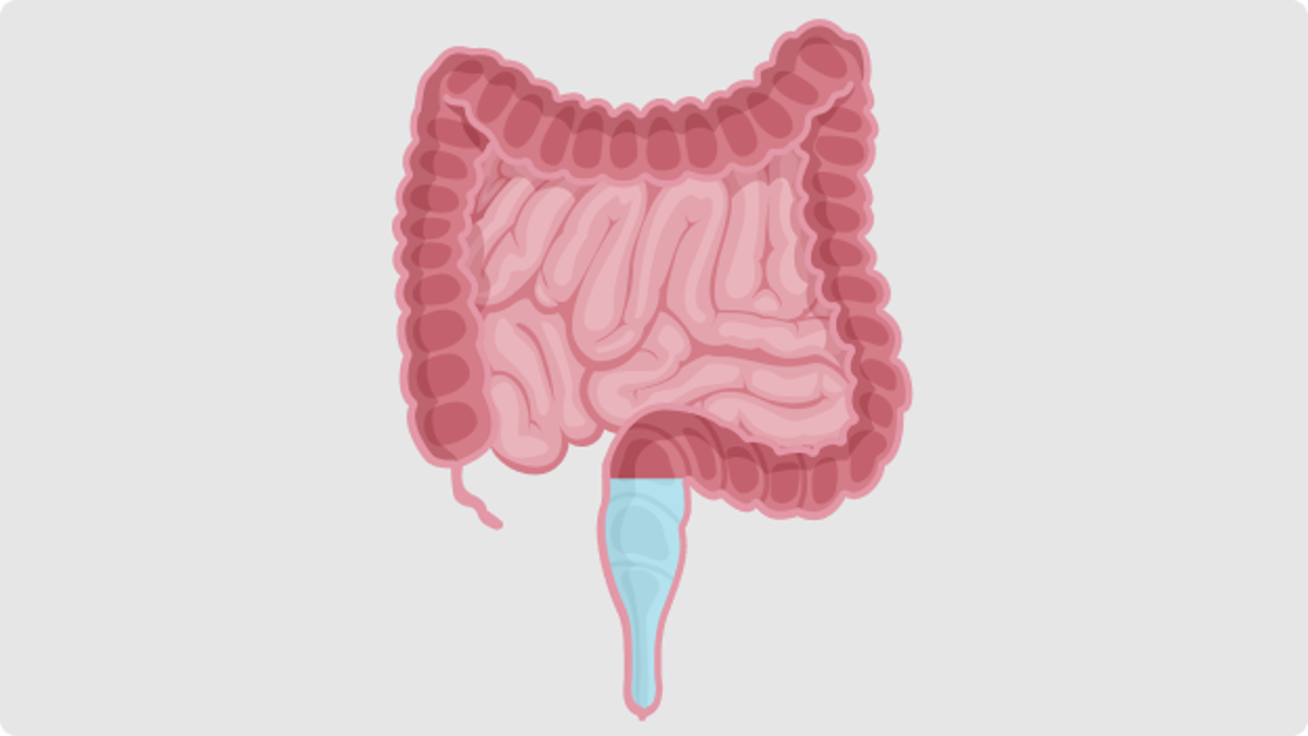 Patients can manage their bowel issues using low-volume TAI