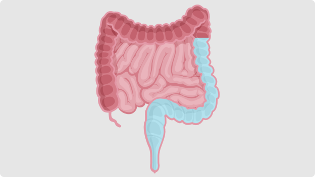 What is high-volume TAI?